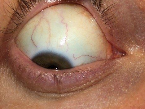 A close up of a person 's eye looking down