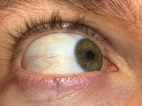 A close up of a person 's green eye looking right