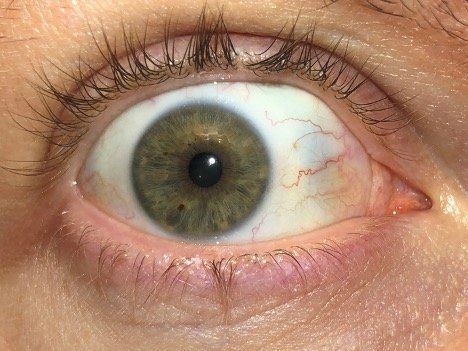A close up of a person 's eye looking at the camera
