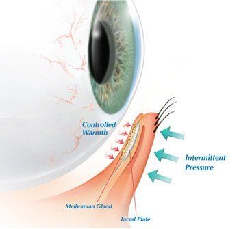 graphic of meibomian glands