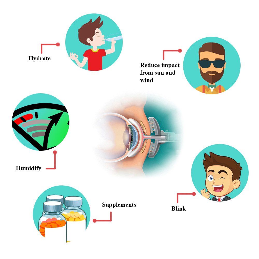 treatment options for dry eyes