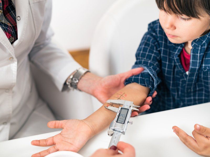 prova allergologica su un bambino