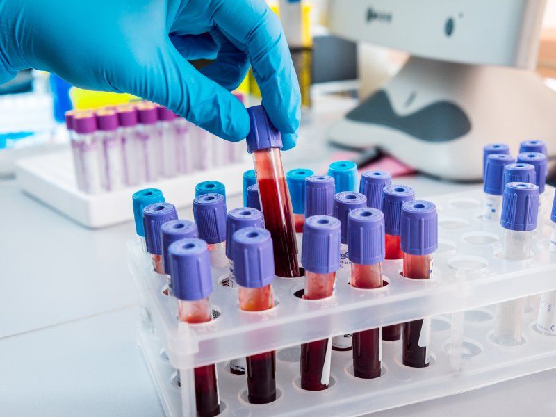 campioni di sangue in provetta
