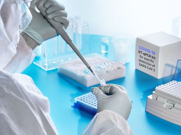 test molecolare covid-19