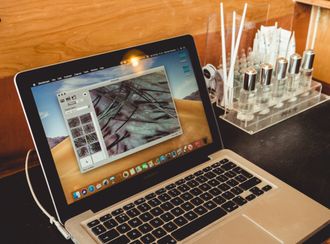 laptop with image of scalp for scalp analysis