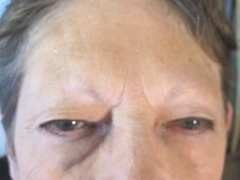 Permanent Makeup Eyebrows before Fair Oaks Permanent Make up Eye Brow Before