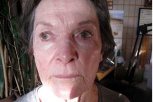 Permanent Makeup eye brows, eye lashes and lips before Sacramento Permanent Makeup eye brows, eye lashes lips before