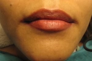 Sacramento Permanent Makeup up Lips after