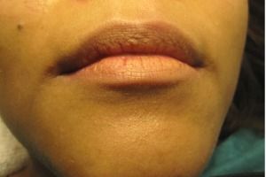 Sacramento Permanent Make up Lips
