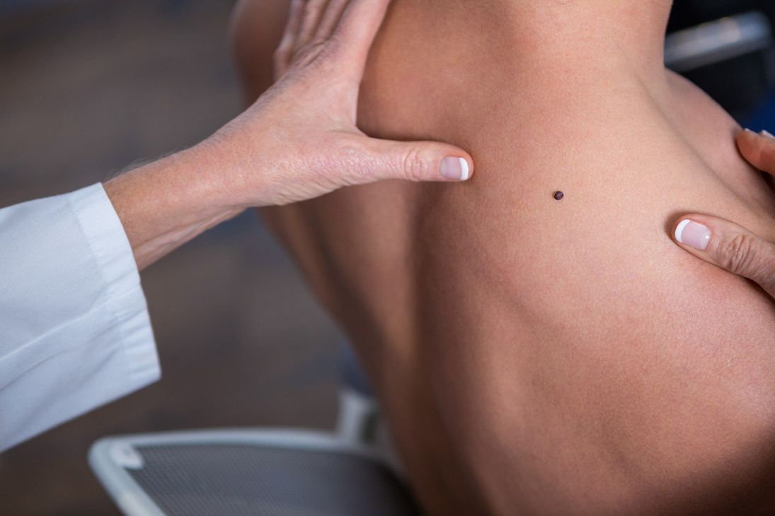 Prodotti dermatologici