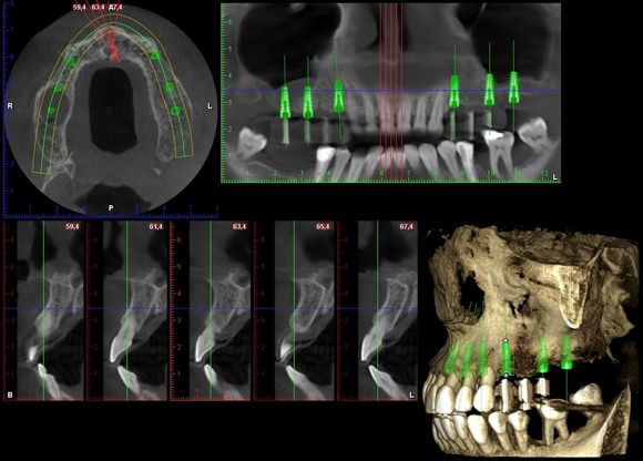 controllo dell'igiene dentale