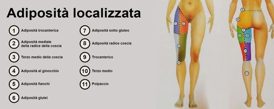 adiposità localizzata