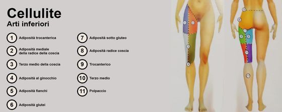 cellulite