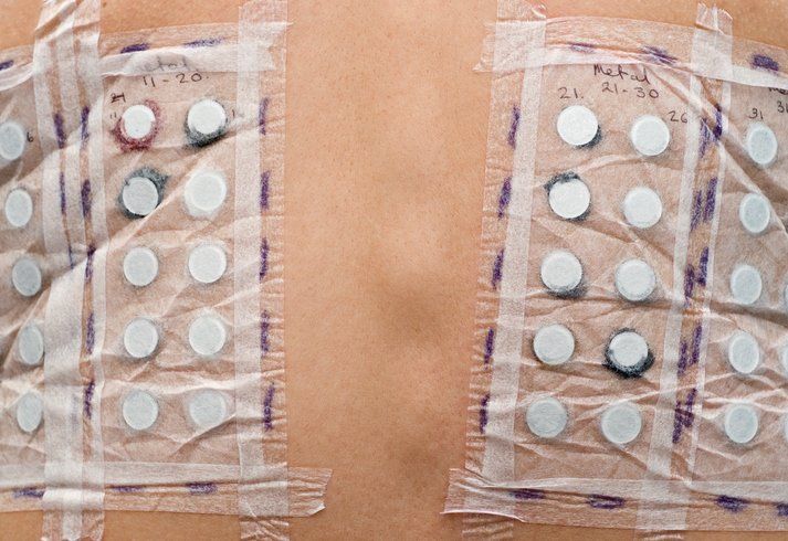 patch test