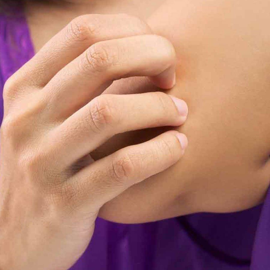 Cura della psoriasi