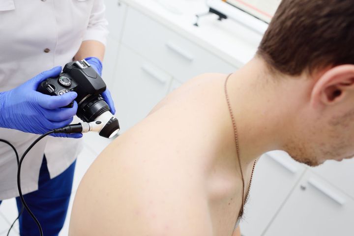 trattamento lipoma cutaneo