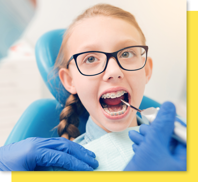Check My Smile | Smile Check Club