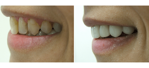 Cosmetic Dentist — Richmond, VA — Dr. Babik & Associates