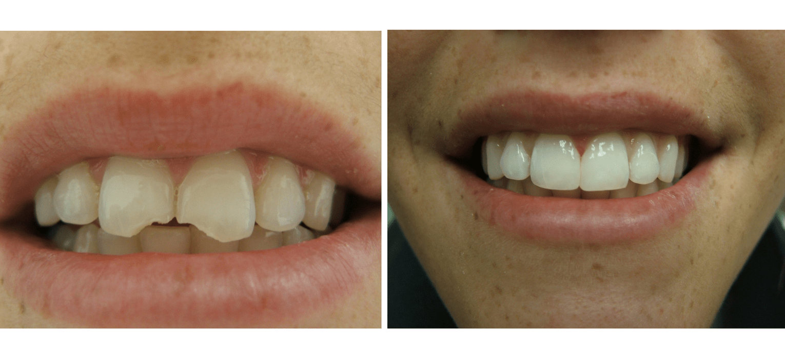 Dental Service — Richmond, VA — Dr. Babik & Associates