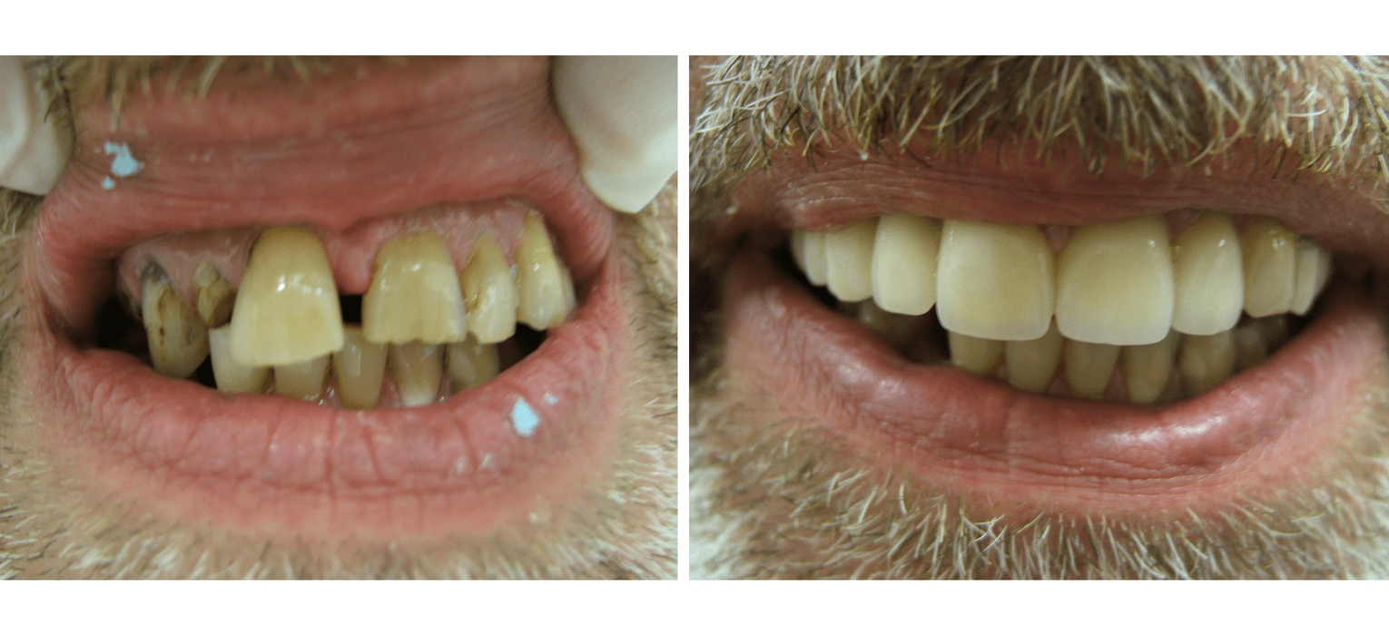 Family Dentist — Richmond, VA — Dr. Babik & Associates