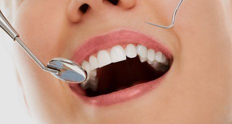 dental treatment