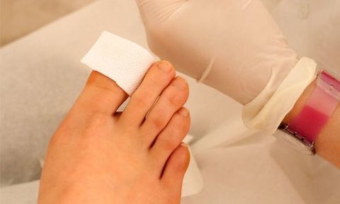 nail therapy