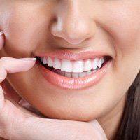 Teeth whitening