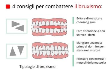 Schema con consigli per evitare il bruxismo