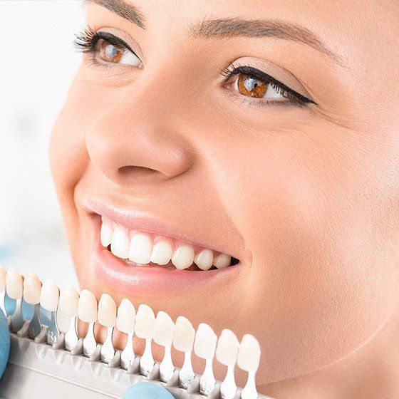 Teeth Whitening — Margate, FL — Crescent Dental Teeth Whitening — Margate, FL — Crescent Dental