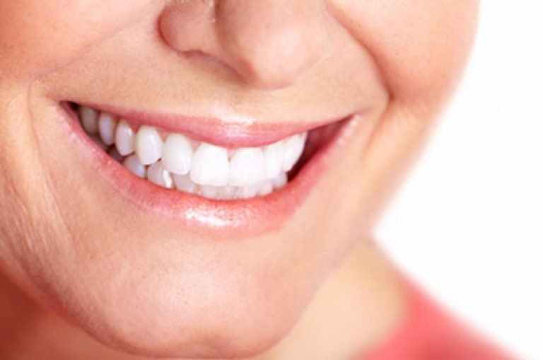 A White, Evenly Aligned Smile | Teeth Whitening in Cincinnati, Ohio