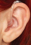 BTE earmold