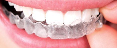Clear aligners