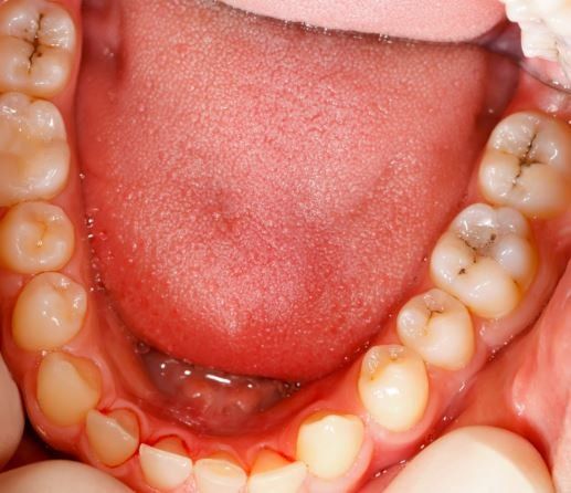 Teeth