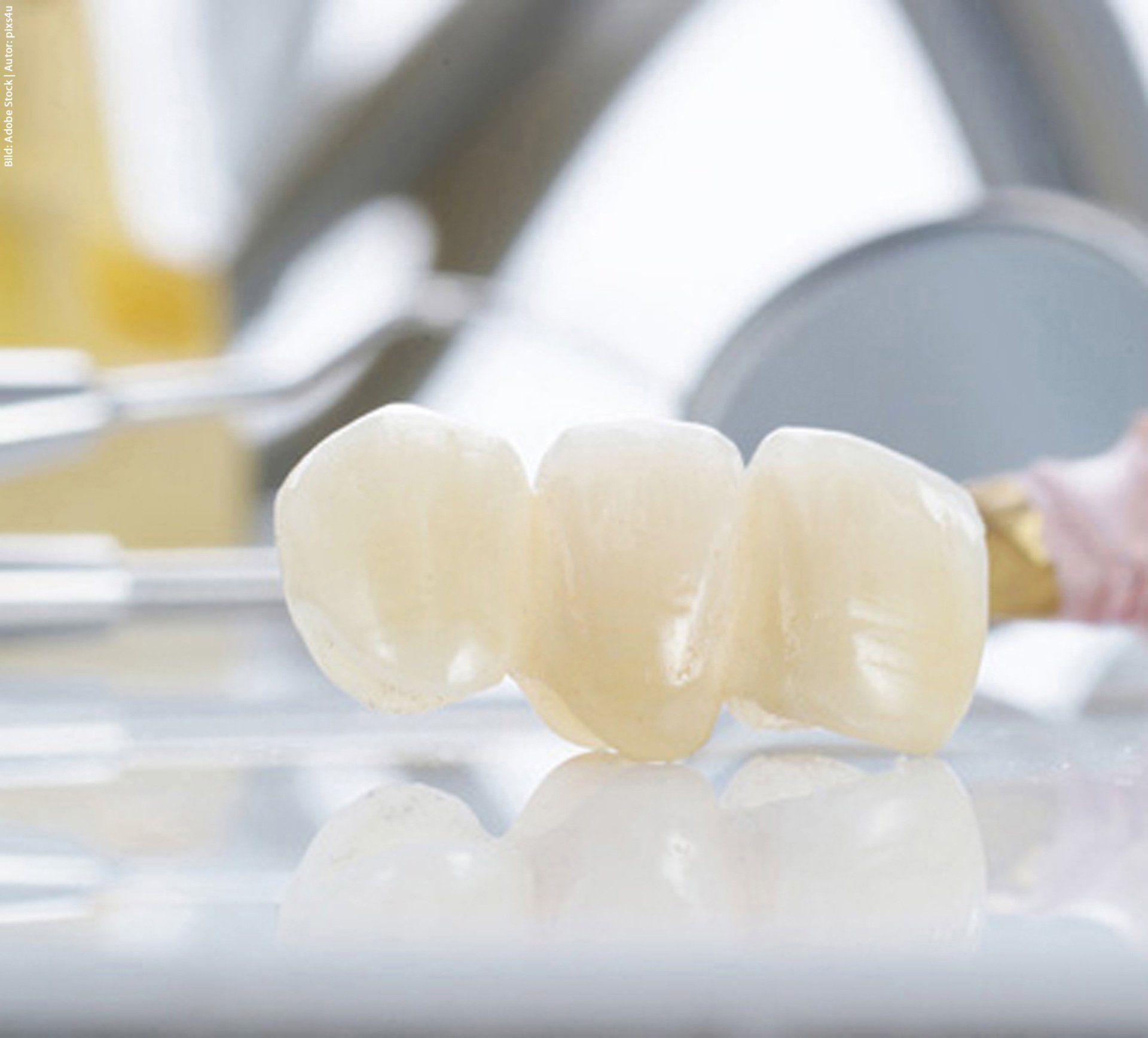 A close-up of a dental bridge placed on a table.