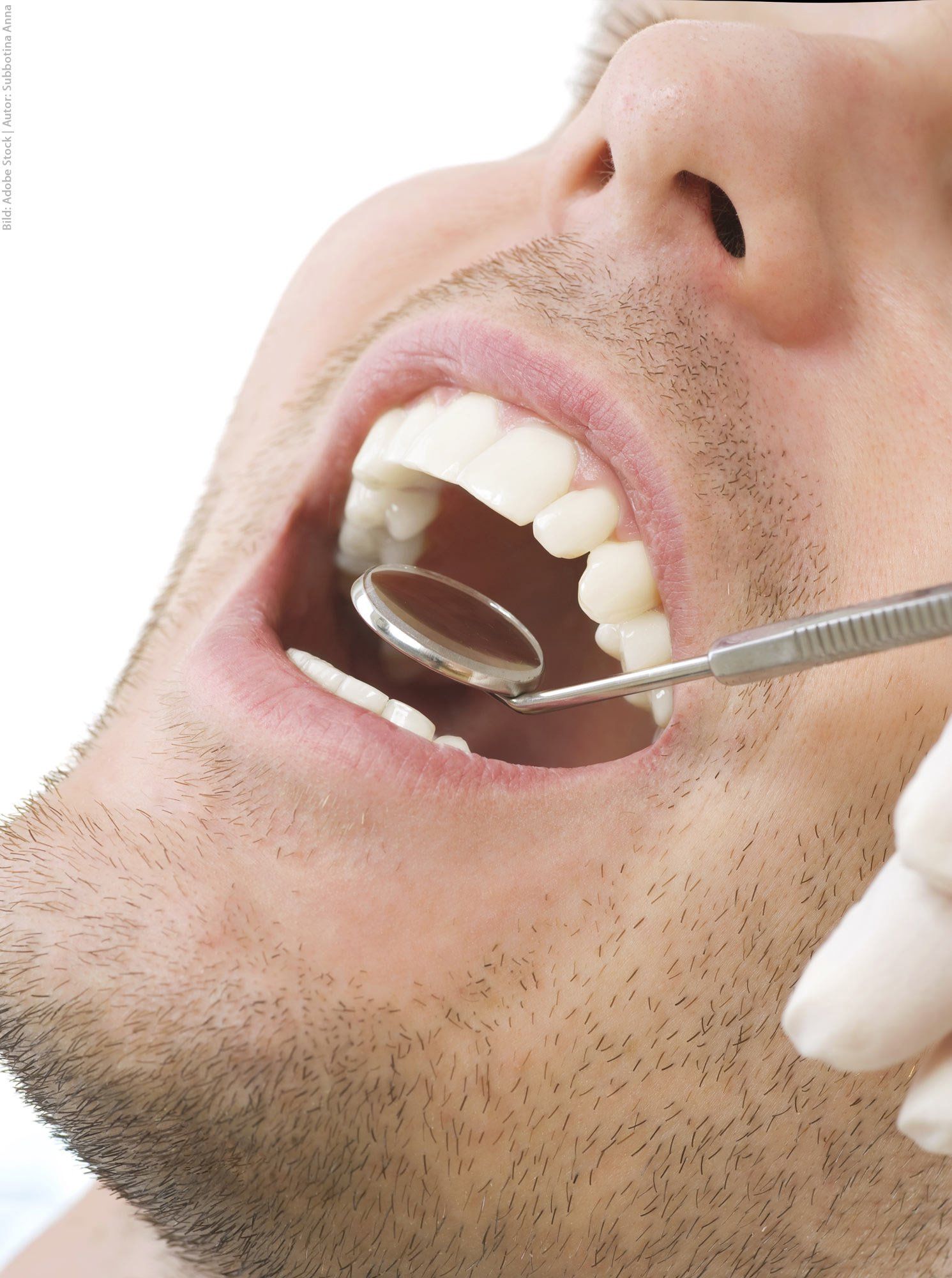 A man is having his teeth examined by a dentist.