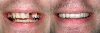 Syosset Dentist | Syosset dental Smile Gallery | Syosset Dentist | Syosset dental Smile Gallery |
