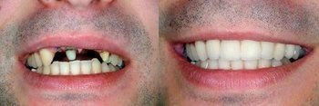 Syosset Dentist | Syosset dental Smile Gallery | Syosset Dentist | Syosset dental Smile Gallery |
