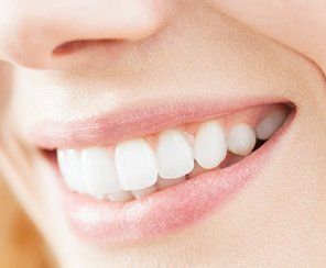 Dental Concern — Close Up Image of Smiling Woman in Warwick, RI Dental Concern — Close Up Image of Smiling Woman in Warwick, RI