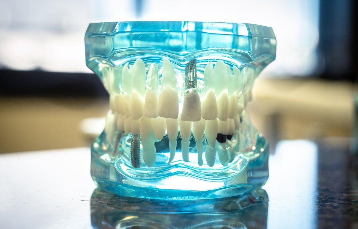 cerec