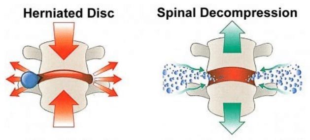Spine Diagram — Hawley, PA — Pocono Chiropractic Clinic Spine Diagram — Hawley, PA — Pocono Chiropractic Clinic