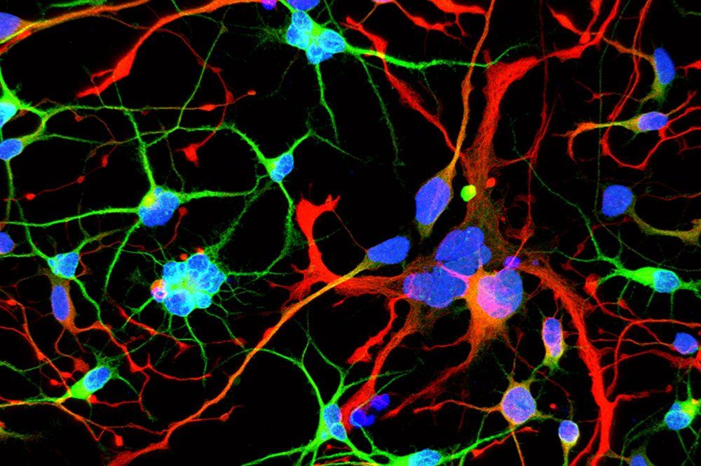 Huntington's Disease