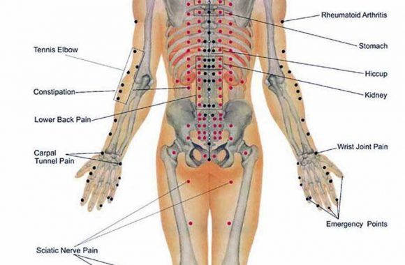 a diagram of a person 's body showing the various areas of the body .