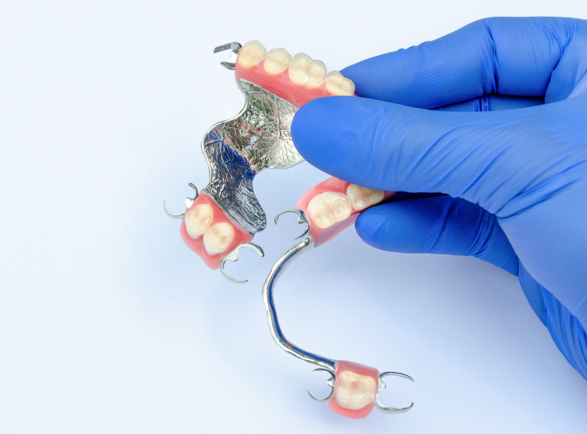 Partial metal dentures Partial metal dentures