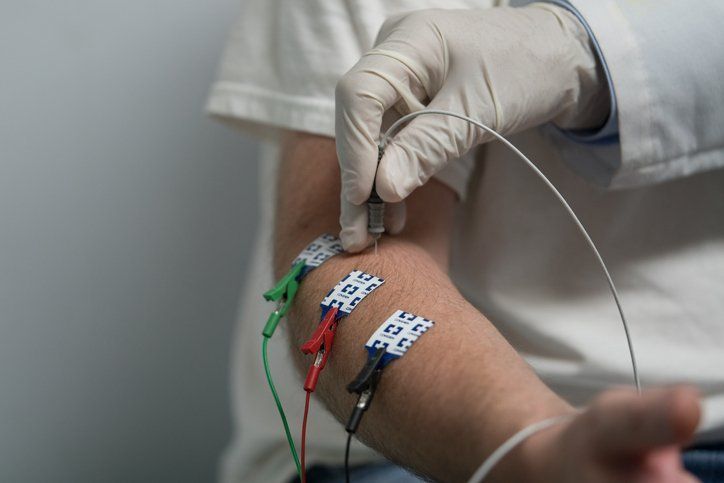 EMG test pad strips on arm