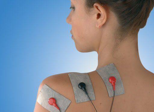 Donna con elettrodi per la stimolazione elettrica sulla schiena, fili rossi e neri, sfondo blu.