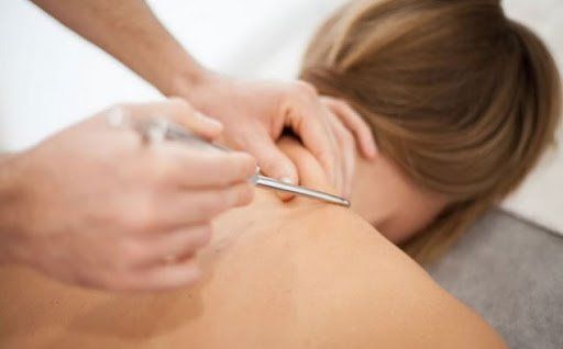Persona sottoposta a trattamento di agopuntura a secco sulla spalla.