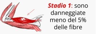 A drawing of a muscle with the words stadio 1 sono danneggiate meno del 5 % delle fibre.