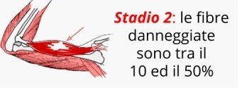 A drawing of a muscle with the words stadio 2 le fibre danneggiate sono tra il 10 ed il 50 %