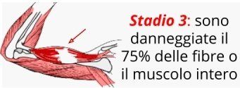 Un disegno di un muscolo con una freccia rossa che lo indica.