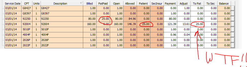 Optometric Billing: Why I Hate Officemate, Part 4